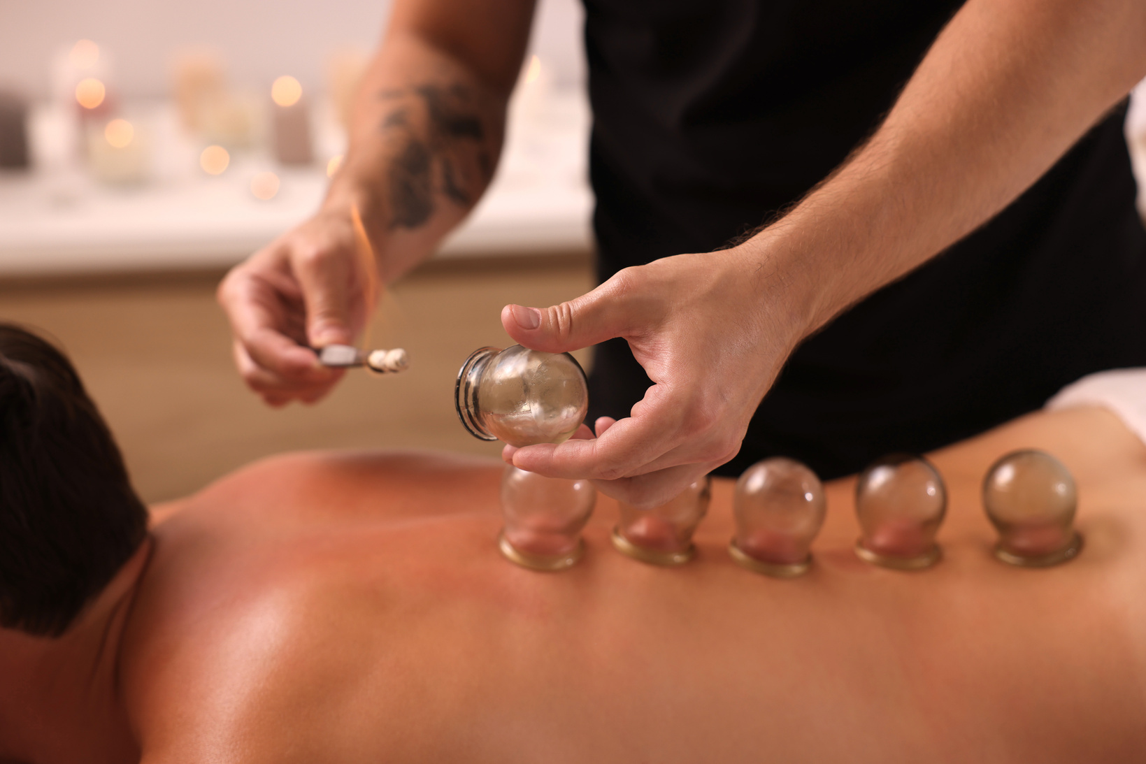 Therapist Giving Fire Cupping Treatment to Patient Indoors, Clos